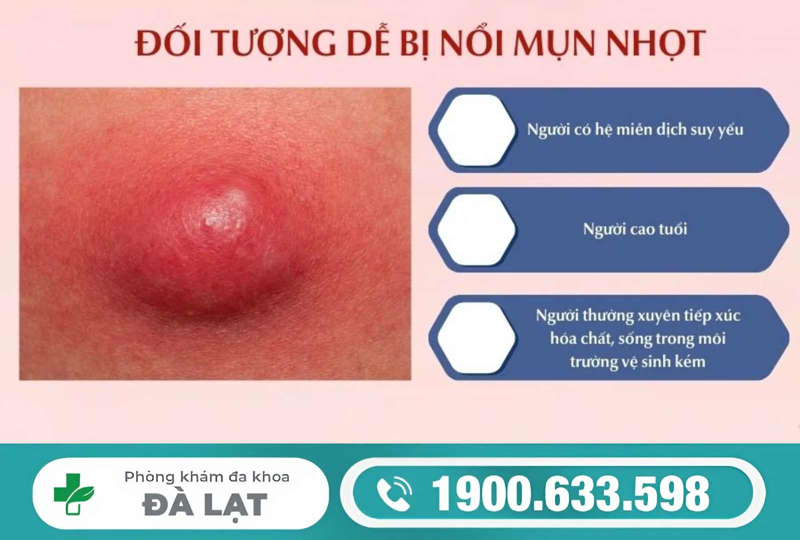 Hình ảnh minh họa